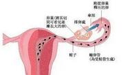 输卵管是女性不孕因素中比率最高的