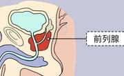 什么是前列腺？前列腺发病率高吗？前列腺增生怎么治疗？