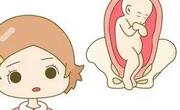 臀位能顺产吗？