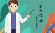 什么原因会引起前列腺癌？