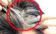 年轻人白头发越来越多是什么原因导致的？