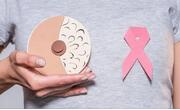 女性应多了解乳腺癌知识！