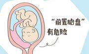 不同时期查出前置胎盘有不同的解决方案