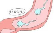 孕前查出输卵管堵塞建议手术治疗！