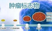 肿瘤标志物高说明什么？是癌症吗？