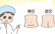 剖腹产是横切好还是竖切好？