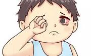 眼屎多是怎么回事？