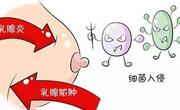乳头皲裂是什么原因导致的？