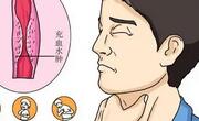食管癌能活几年？