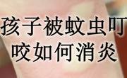 小孩子被蚊子咬了怎么止痒消肿？