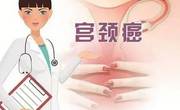 预防宫颈癌最管用的方法