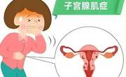子宫腺肌病能怀孕吗？