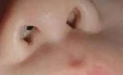 宝宝鼻屎多是怎么回事？如何预防鼻屎增多？